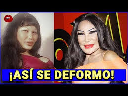 Check spelling or type a new query. Lyn May Relata Transformacion De Su Cara By Famosos Al Desnudo