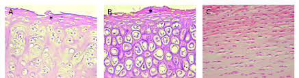 It contains no nerves or blood vessels, and its structure is relatively simple. Three Different Types Of Cartilage Hematoxylin And Eosin Staining Of Download Scientific Diagram