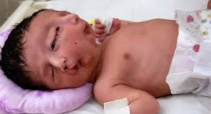 When is a disease considered rare?