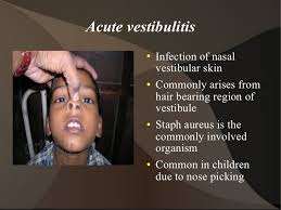 Nasal vestibulitis is the infection of the vestibule inside the opening of the nostril. Ext Nose