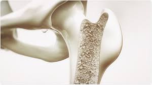Check spelling or type a new query. Too Much Vitamin D Could Be Harmful To Bones
