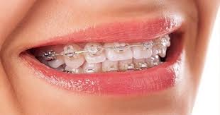 Http Alldentalsolutionsmelbourne Blogspot Com Au 2016 10 Look For A Certified Orthodontist Melbourne Html