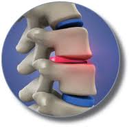 Image result for vyhřezlá ploténka