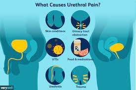 Burning in the urethra in women: Urethral Pain Causes Treatment When To See A Doctor