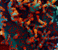 It takes 15 days after getting the second dose to have the best protection. Lasting Immunity Found After Recovery From Covid 19 National Institutes Of Health Nih