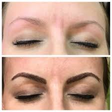 Laser technology has brought us a permanent solution to remove unwanted hair, leaving skin feeling smooth and healthy. Laser Hair Removal In Fairfax Yelp