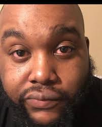 Tyrone Whitehead (@foexboob) • Instagram photos and videos