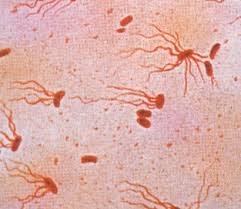 Salmonella bacteria typically live in animal and human intestines and are shed through feces. Salmonella Typhi Microbiology Medbullets Step 1