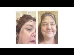 Grateful Patient Series: Colleen Johnson, Dr. Toman & Dr. Tabor