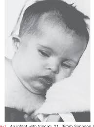 Genetic Counseling and Genetic Screening