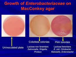 Macconkey Agar Plate Purpose Ingredients And Principle Laboratoryinfo Com Agar Growth Medium Microbiology