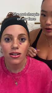 Dot Near Eye Sharpie