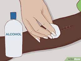 Apply more petroleum jelly and replace the bandage as needed. How To Remove Surgical Staples 8 Steps With Pictures Wikihow