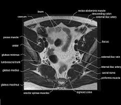Check spelling or type a new query. Mri Pelvis Anatomy Free Male Pelvis Axial Anatomy