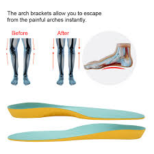As a reward, get 10 % off voucher*. Rdeghly Arch Support Insoles Shoe Insoles 5 Types Orthotic Corrective Arch Support Cushion Shoe Inserts Insoles Pads For Kids Walmart Canada