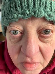 Umpire's Bad Calls in Baseball Games