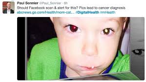 Moreover, these patients have a longer time from onset to admission and their prognosis is worse than patients without digestive symptoms. Cellphone Photo Revealed Toddler S Eye Cancer
