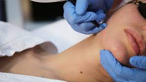 Our services our practice meet our providers the patient experience read more patient reviews Woman Getting Laser Face Treatment Stock Footage Video 100 Royalty Free 1016883712 Shutterstock