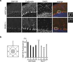 Lee & associates offers an array of real estate services including commercial real estate brokerage, integrated services, and construction services. The Sun2 Nesprin 2 Linc Complex And Kif20a Function In The Golgi Dispersal Scientific Reports