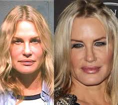 Daryl Hannah Plastic Surgery Before After Celebrity Plastic Surgery Plastic Surgery Botox Lips