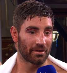 Frank Buglioni left dripping in blood after horror cut above eye in Fanlong  Meng stoppage
