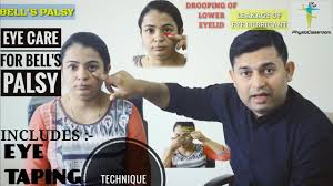 If a specific cause for bell’s palsy is identified, such as infection, that cause will be treated. Eye Care Eye Taping Technique For Bell S Palsy Youtube