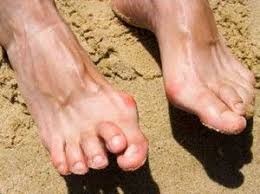 Pin On Foot And Ankle Health Tips