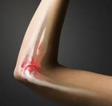 The way we found this was i was having pain in my hip so bad i could hardly stand it. Secondery Bone Cancer Cancerwalls