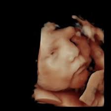 ADVANCED ULTRASOUND SERVICES