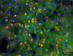 We did not find results for: Counting Cytoplasm Nuclei Labelled In Different Channels In Qupath Image Analysis Image Sc Forum