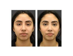 Profile for Been Facial Plastics