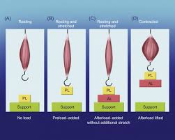 Image result for Preload