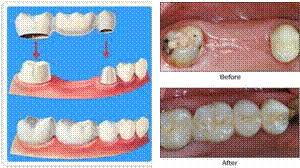 We did not find results for: Pembuatan Gigi Tiruan Jb Dental Klinik