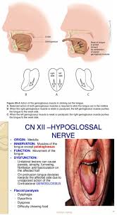 Hypoglossal Nerve Injury Deviation Of Tongue Towards The Affected Side Genioglossus All Muscles Hypoglossal Nerve Myofunctional Therapy Muscle Stick