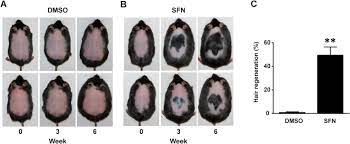 Fluoride & hair loss many people see their thinning hair as a sign of aging, but the truth is hair loss comes from many sources. Sulforaphane Promotes Murine Hair Growth By Accelerating The Degradation Of Dihydrotestosterone Sciencedirect