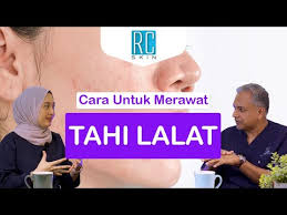 Kanser serviks adalah kanser ketiga paling tinggi dihidapi wanita di negara ini membabitkan 12 peratus daripada semua kanser yang dihidapi wanita selepas kanser payudara dan usus besar. Video Tanda Tanda Kanser