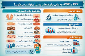 بایگانی‌های گلوبولین متصل‌شونده به هورمون جنسی - آزمایشگاه سعید