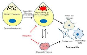 It is an apotheosis of an acute inflammatory condition or a trauma of the organs situated in the abdominal cavity. Jci Trypsin Activity Governs Increased Susceptibility To Pancreatitis In Mice Expressing Human Prss1r122h