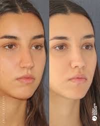 La Cosmiatra Nancy Álvaro es la profesional que brinda cuidados  especializados de la piel, garantizando un post operativo óptimo para el  paciente. ✨ Comunícate con nosotros y conocé todos nuestros servicios: 📱