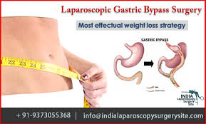Pin On Laparoscopic Gallbladder Surgery In India