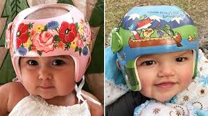 How An Artist Helps Helmet Wearing Babies Attract Smiles Not Stares Baby Helmet Helmet Paint Painted Rocks Kids