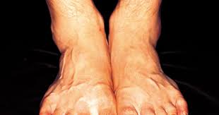 Pin On Health Exercise