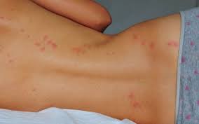 Pin On Body Health