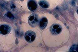 As publicações sobre a realização de técnicas de imunocitoquímica (icq) em amostras coradas com. Giemsa Stain Wikipedia