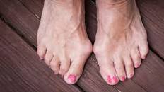 Resultado de imagen para site:www.ocu.org/ eliminar hongos uñas