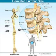 To simplify things, i'm going to split the back into three sections; Low Back Pain Exercise Causes Treatment Symptoms Diagnosis