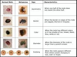 You certainly want to do everything that you can to reduce your chances of. Pin On Helpful Sites