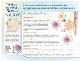 Image result for Breast Cancer Staging