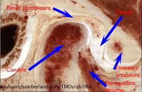 Les douleurs de gorge peuvent apparaître à n'importe quel moment. Trouble A L Articulation Temporo Mandibulaire Orthodontiste A Quebec