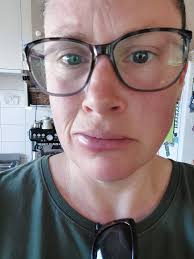 Managing Aggressive Bees and Reducing Stings